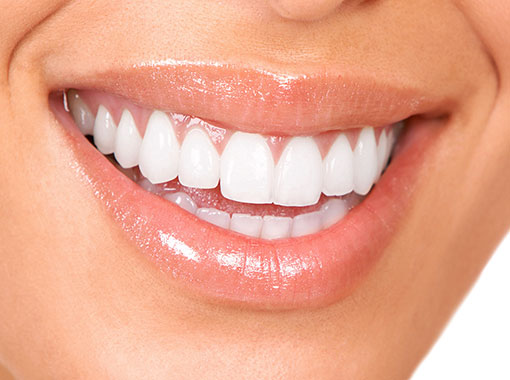 dental veneers will improve the appearance of your smile
