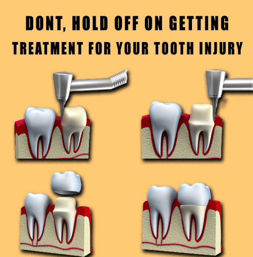 Treatment for your tooth injury In Fontana CA