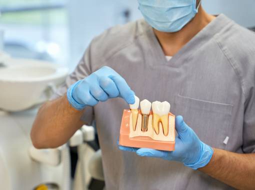 Dentist holding a dental implant model