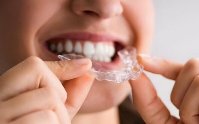 Invisalign vs. Traditional Braces: Making the Right Choice